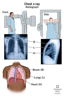 Robotic X-ray imaging - Siemens Healthineers