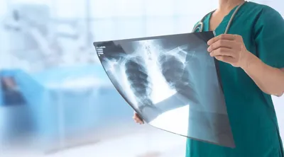 What to expect during an X-ray