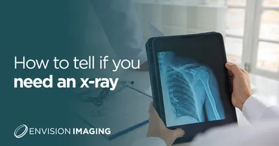 Chest x-ray Archives - teachIM