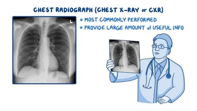 NOMAD™ Pro 2 Portable Dental X-Ray - Aseptico Inc.