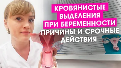 Как отличить месячные от кровотечения: симптомы и причины