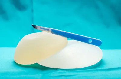 Breast Implants for Reconstruction After Mastectomy
