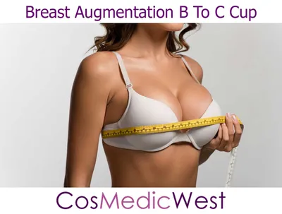 IDEAL Implants in Guilford CT - Structured Saline Breast Implant