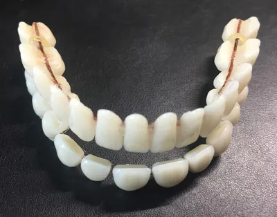 Лучшие искусственные зубы