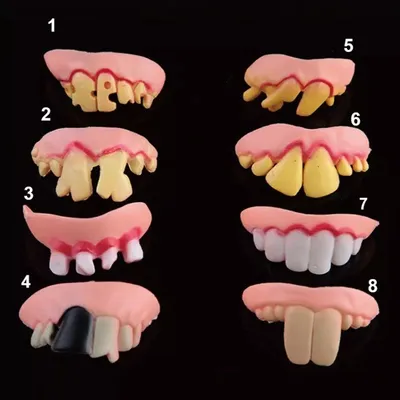 Зубы искусственные IVOCRYL фронтальные, верхняя челюсть, цвет BL1, фасон 34  уп/6шт 630740 купить в Казани по цене ДИОН-медсервис