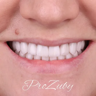 Накладка на зубы искусственные зубы 15558 (ID#1821984019), цена: 634 ₴,  купить на Prom.ua