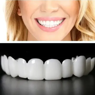 Накладные виниры для зубов и красивой улыбки Nice Price 12771901 купить в  интернет-магазине Wildberries