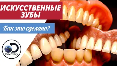 Зубной Протез Искусственные Зубы - Бесплатное фото на Pixabay - Pixabay