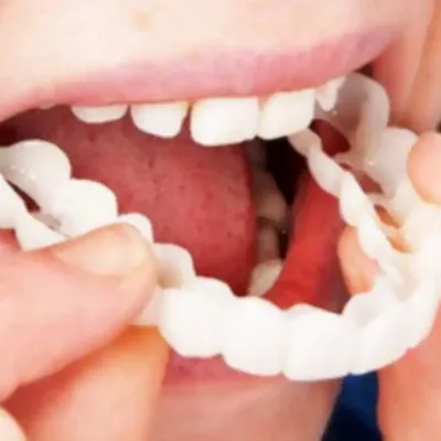 Искусственные зубы Vivodent S PE от Ivoclar в Минске - Белая лаборатория