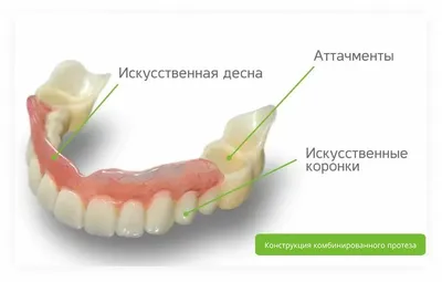 Плохие накладные зубы для селфи купить