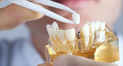 Лучшие искусственные зубы в истории кино