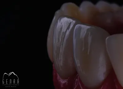 39. Искусственные зубы — Наири-x
