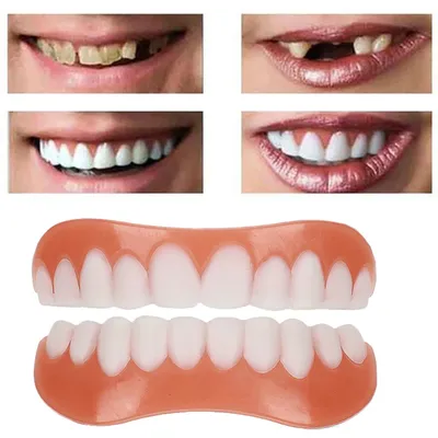 Искусственные зубы на белой предпосылке с космосом экземпляра Стоковое  Изображение - изображение насчитывающей модель, дантист: 132025143