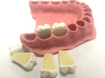 Зубные протезы (сэндвич) комбинированные нового поколения: цены в  стоматологии — ROOTT