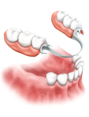 Искусственные зубы на белой предпосылке с космосом экземпляра, концом-вверх  Стоковое Изображение - изображение насчитывающей медицинско, рот: 145717521