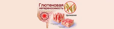 Влажный корм Royal Canin Gastrointestinal Moderate Calorie для кошек при  панкреатите и острых расстройствах пищеварения 85