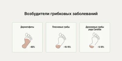 Обработка ногтей от грибка, онихомикоза в Центре подологии СТОПАМЕР