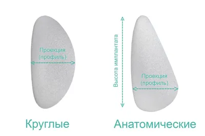 Грудные импланты: виды, размеры, формы и сколько стоят – Mammaclinic