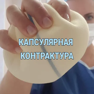 Капсулярная контрактура после маммопластики