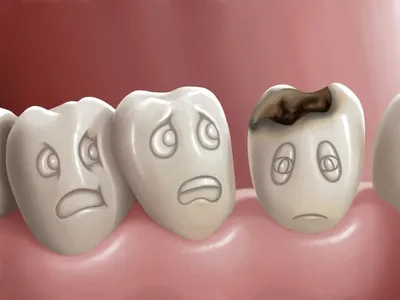 Лечение кариеса постоянных и молочных зубов у детей с раннего возраста. Цены