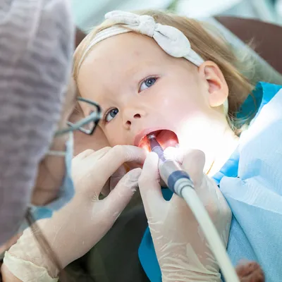 Основные меры профилактики кариеса зубов у детей