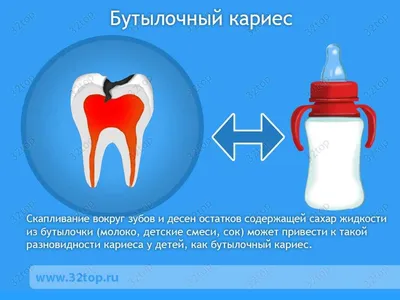 Кариес у детей - лечение детского кариеса, профилактика, признаки, симптомы