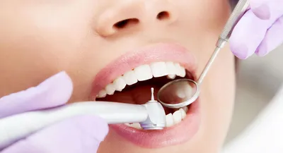 Лечение пришеечного кариеса зуба в Москве ⚡ по цене от от 2100 ₽