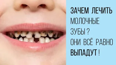 Детский Стоматолог - Дядя Костя - Как испортить ребёнку зубы быстрее всего  с самого раннего возраста. Или От ночной бутылки до первой дырки (в зубе)  Бутылочный кариес - этот запрос в гугле