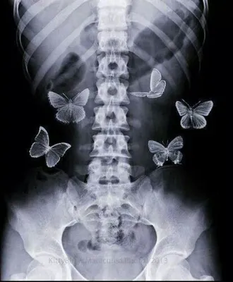 Картинки бабочки в животе фотографии