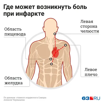 БОЛИ В ОБЛАСТИ СЕРДЦА – Medikas