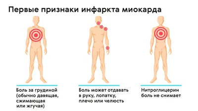 Боль в области сердца – причины возникновения заболевания, какой врач  лечит, диагностика, профилактика и лечение