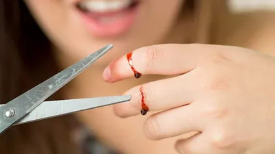 Женщина режет вены на руке, хочет покончить с собой с помощью бритвы  стоковое фото ©andriano_cz 160177858