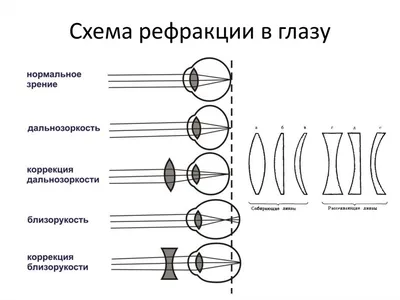 Стереокартинки для тренировки глаз