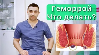 Тромбированный геморрой: причины, диагностика, симптомы и лечение