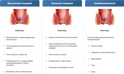 Лечение геморроя – лучшие клиники в Москве • Русский Доктор