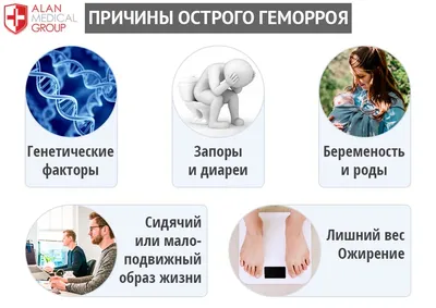 Геморрой: лечение, симптомы, причины, виды профилактика, последствия и  диагностика заболевания