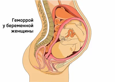 Лечение геморроя в клинике в Челябинске - Клиника «Вся Медицина»
