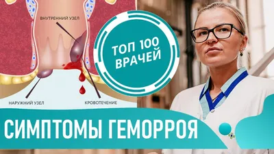 ТОП-14 препаратов от геморроя - рейтинг хороших средств 2021