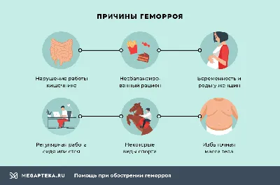 Почему развивается геморрой и как его предотвратить