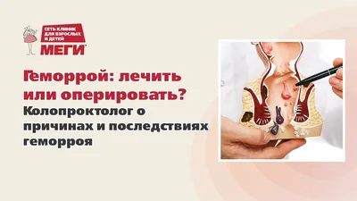 Геморрой: причины, виды, методы лечения и последствия для здоровья