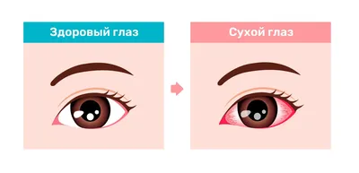 Строение органов зрения: как устроен глаз человека (подробная анатомия) |  World Vision Clinic