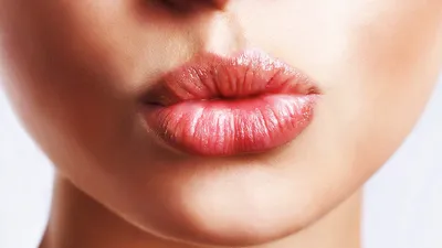 Трескаются губы: почему, какого витамина не хватает, что делать | РБК Life