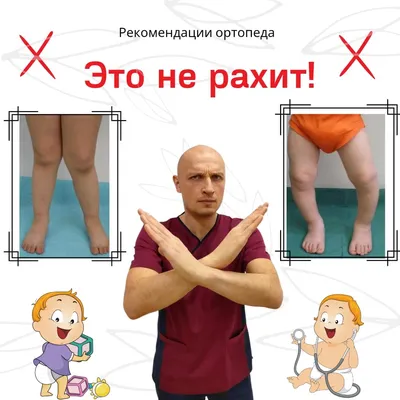 Рахит: причины возникновения, симптомы, признаки и профилактика рахита