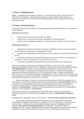 Рахит – известные и неизвестные факты