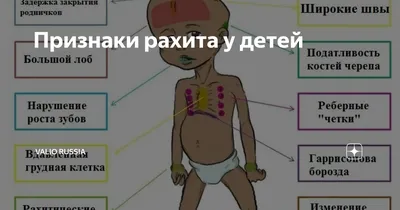 Рахит у детей: Современные аспекты.В.Г.Майданник.2006