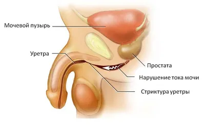 Врождённые аномалии уретры | Катибов | Вестник урологии