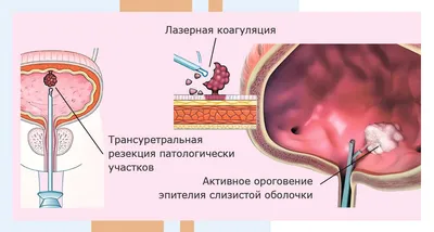 Цистоскопия мочевого пузыря в клиниках Москвы • Русский Доктор