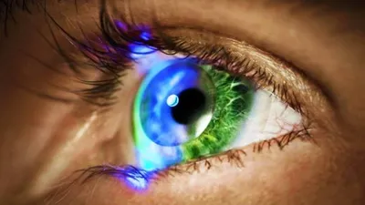В обоих глазах начальная стадия катаракты,один глаз видит нормально,а в  другом зрение резко упало,нужно ли срочно делать операцию ?» — Яндекс Кью