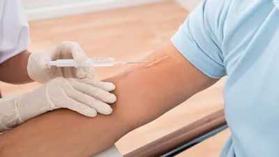 Келоидные рубцы: лечение, после, фото | Интернет-журнал Estetmedicina.ru