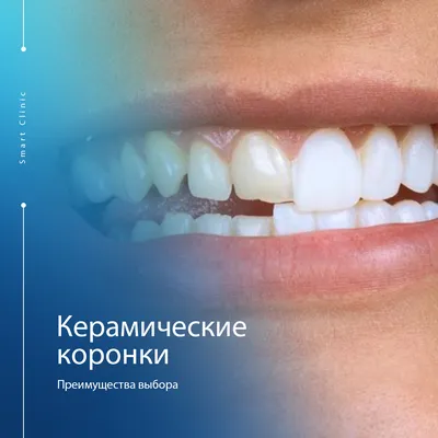 Цельнокерамические зубные коронки — Добрый доктор